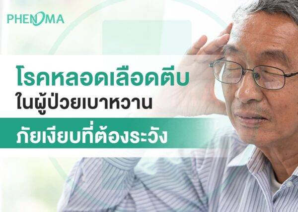 Atherosclerosis in diabetic patients โรคหลอดเลือดตีบในผู้ป่วยเบาหวาน